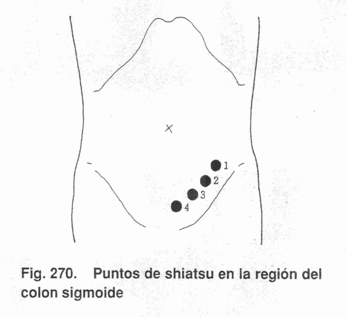 Línea Colon Descendente