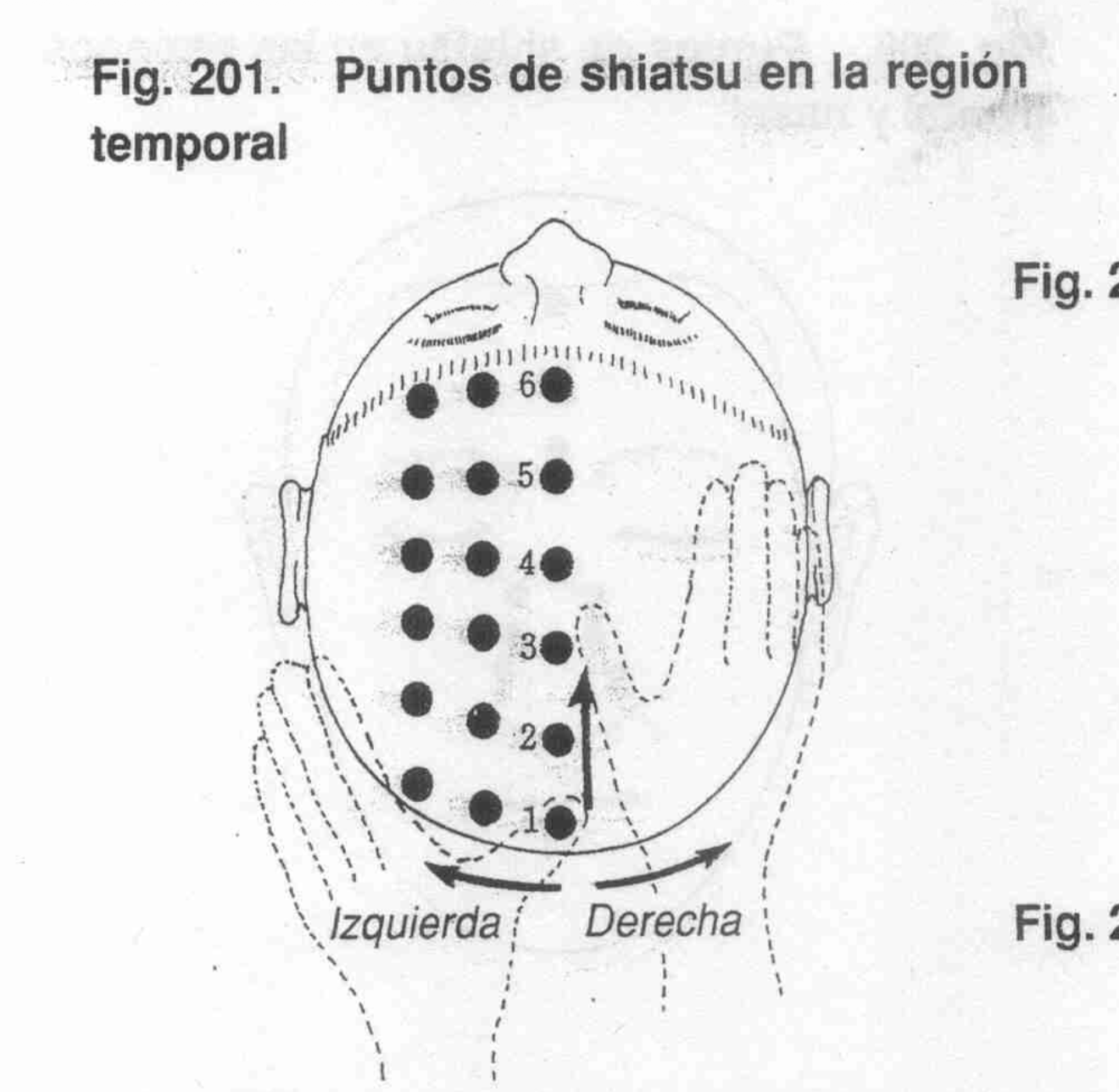 Aplicación en región parietal
