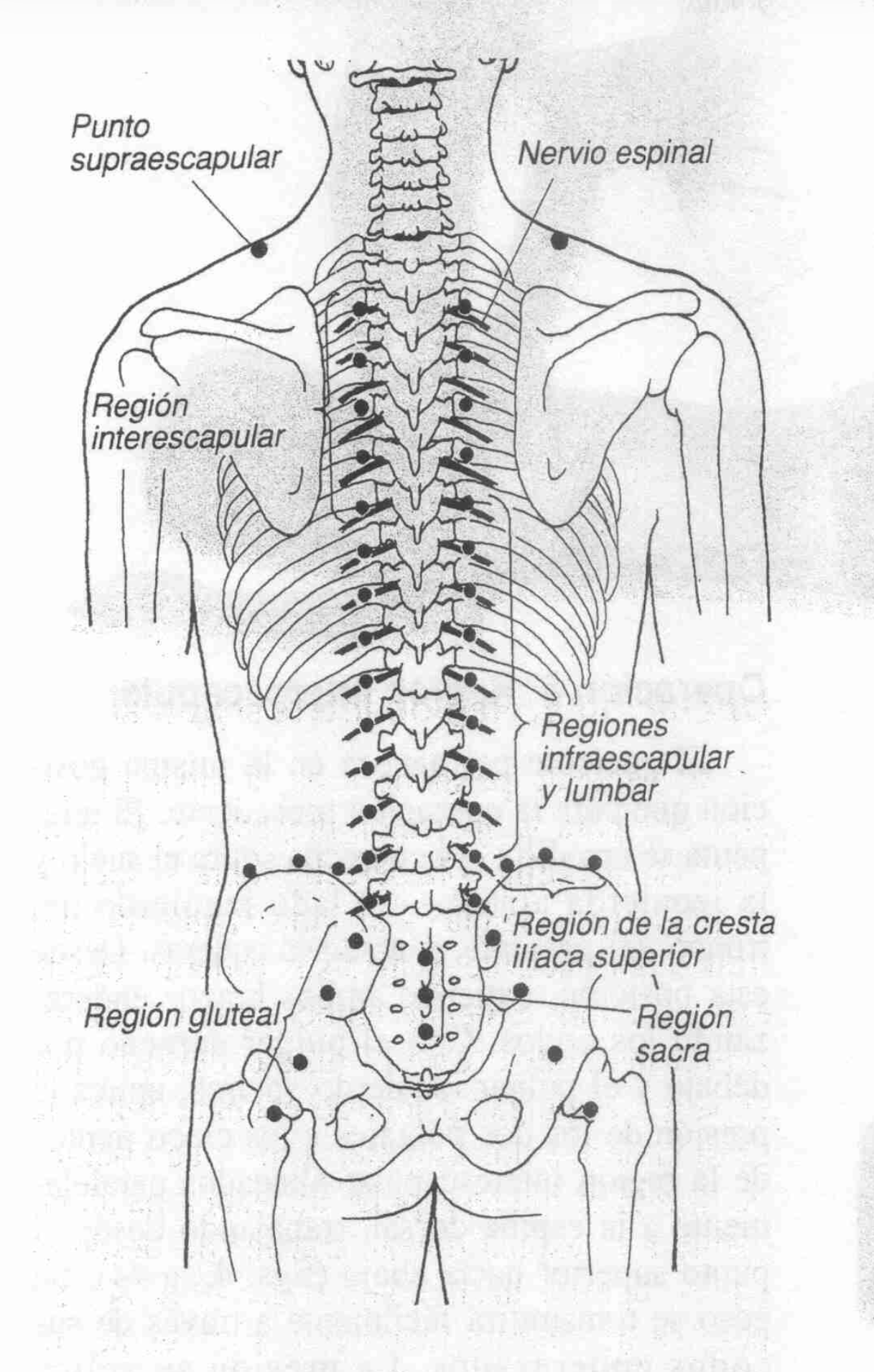 Operación 4 - Foto 4