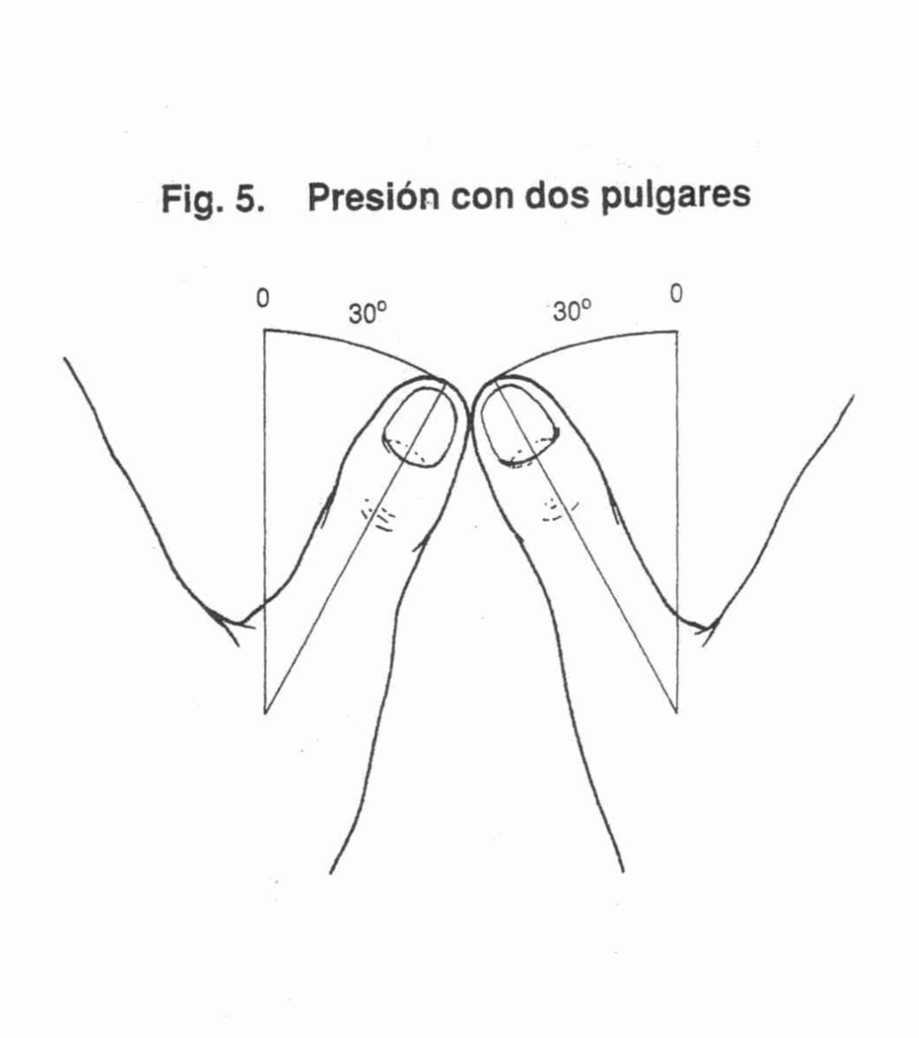 Operación 1 - Foto 2
