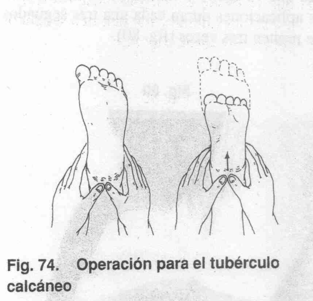 Operación 15 - Foto 2