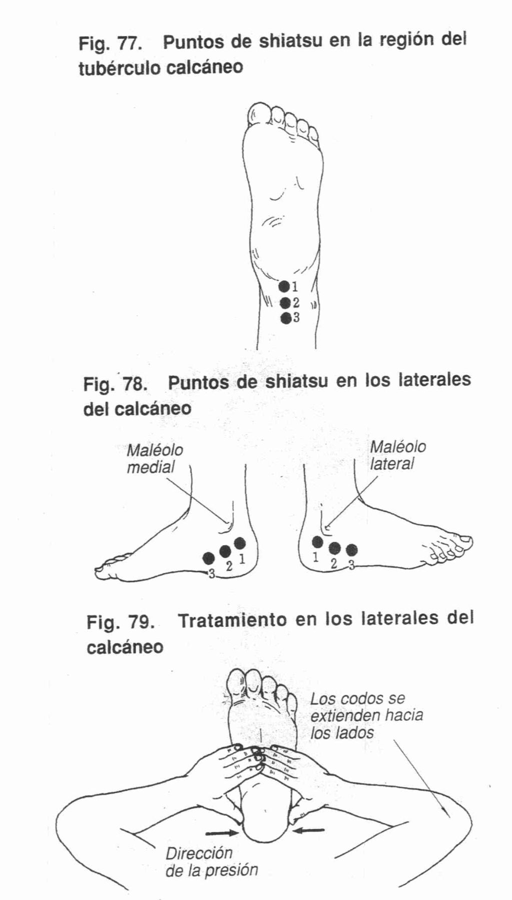 Operación 16 - Foto 1