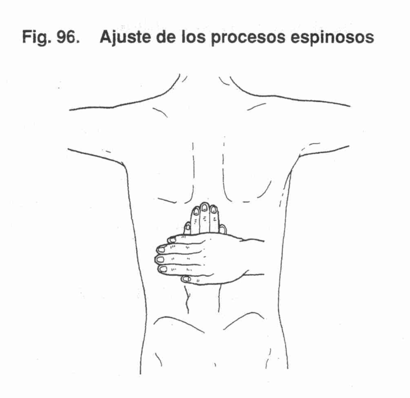 Operación 24 - Foto 2