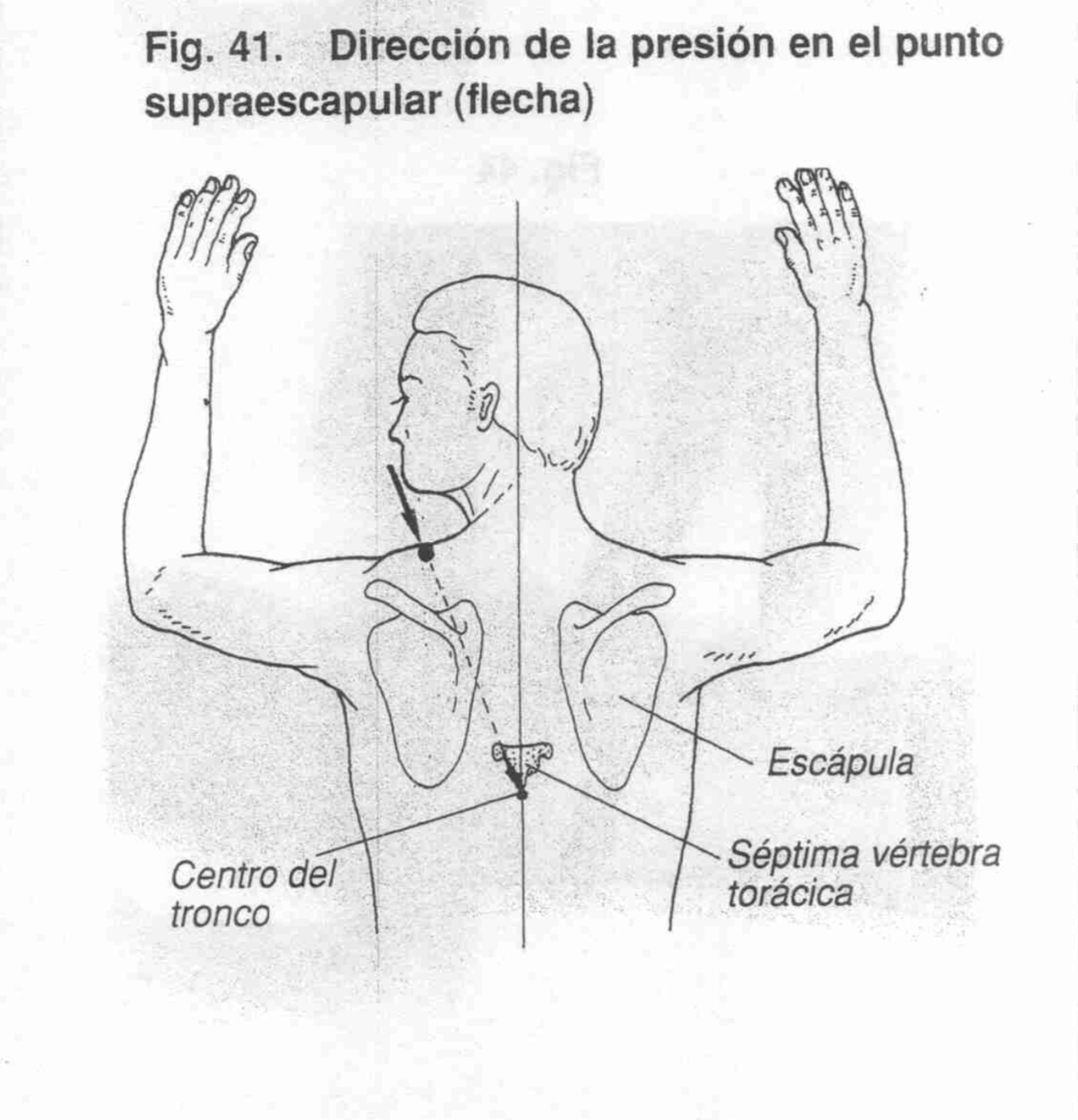 Operación 4 - Foto 3