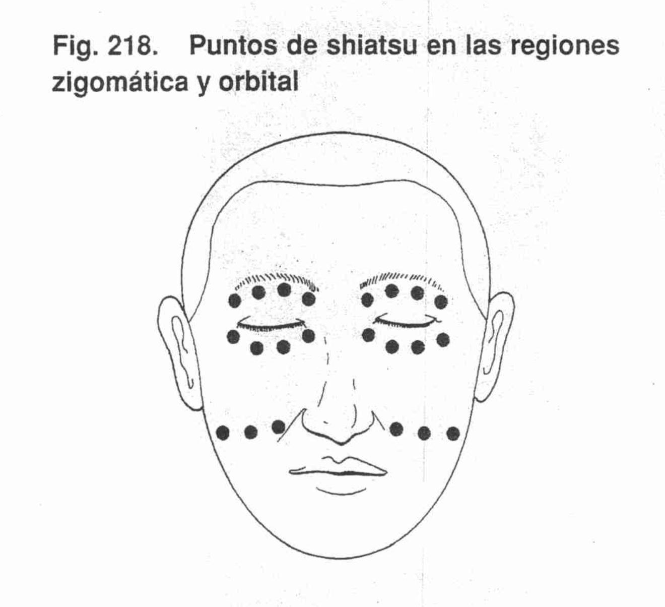 Puntos región nasal