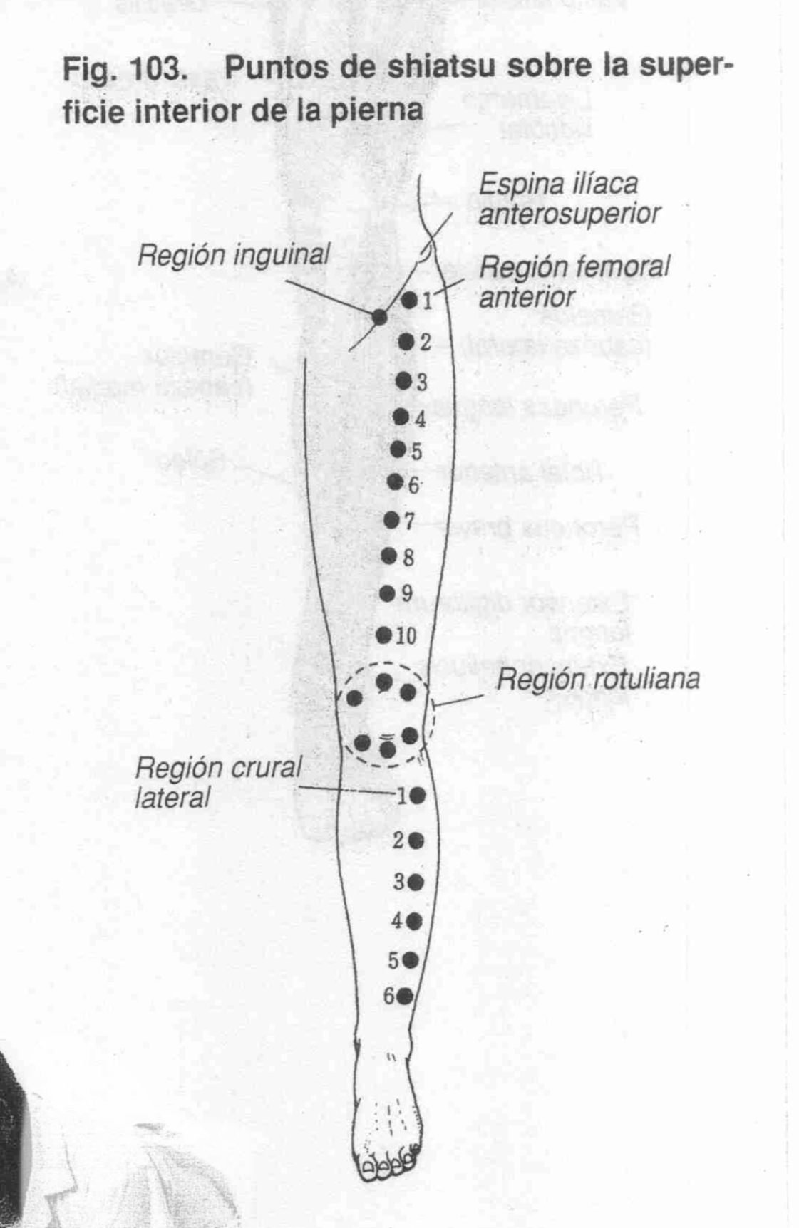 Abordaje Inguinal B