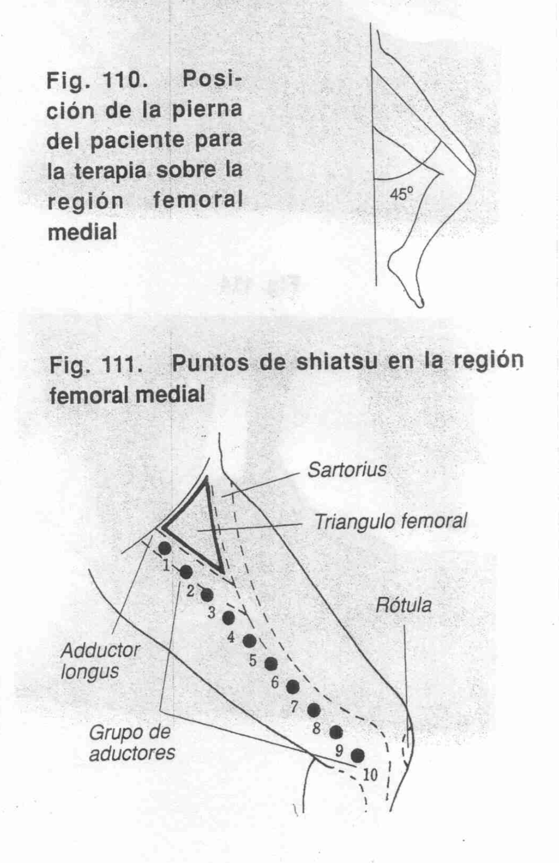 Aductores Apertura