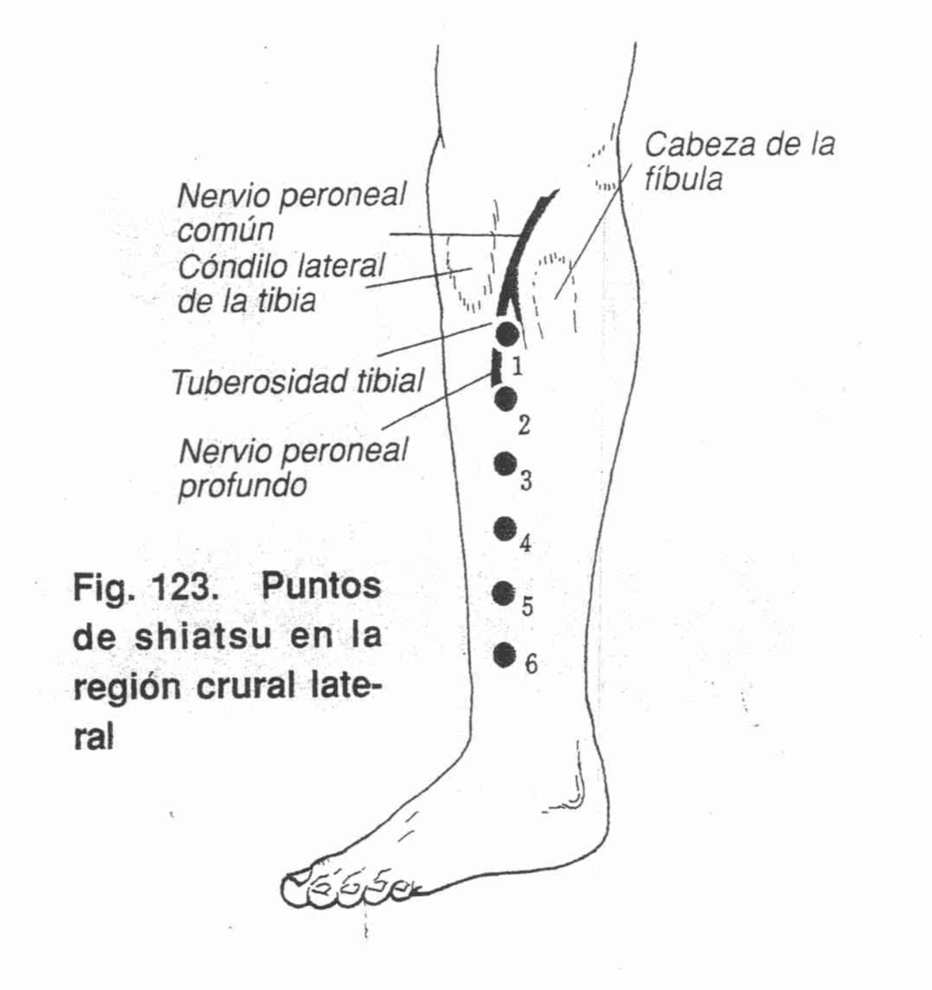 Abordaje Sural