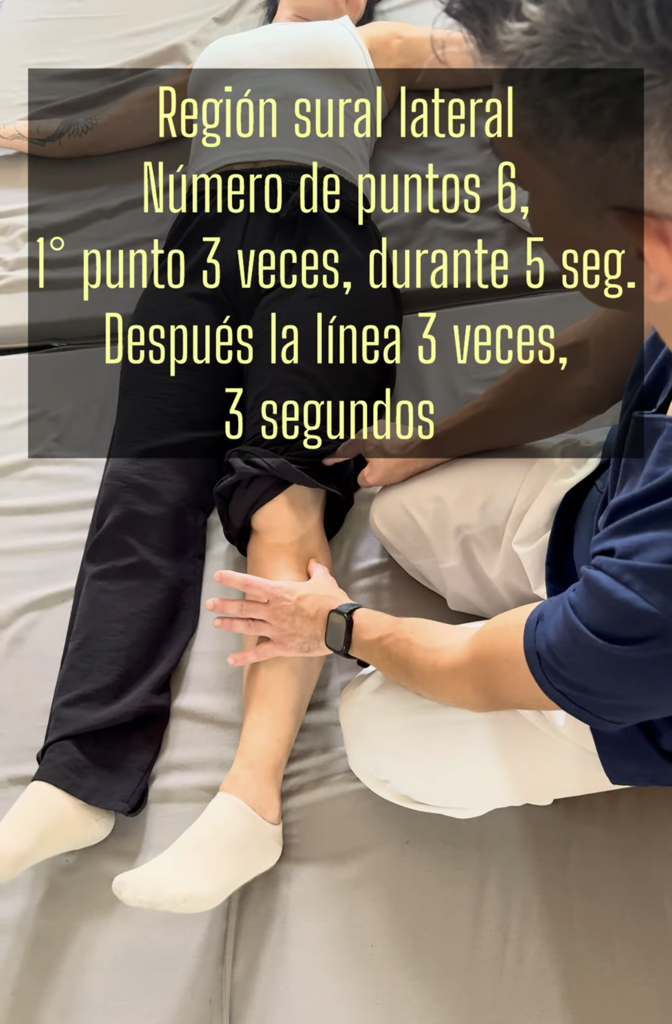 Esquema Nervio Peroneal
