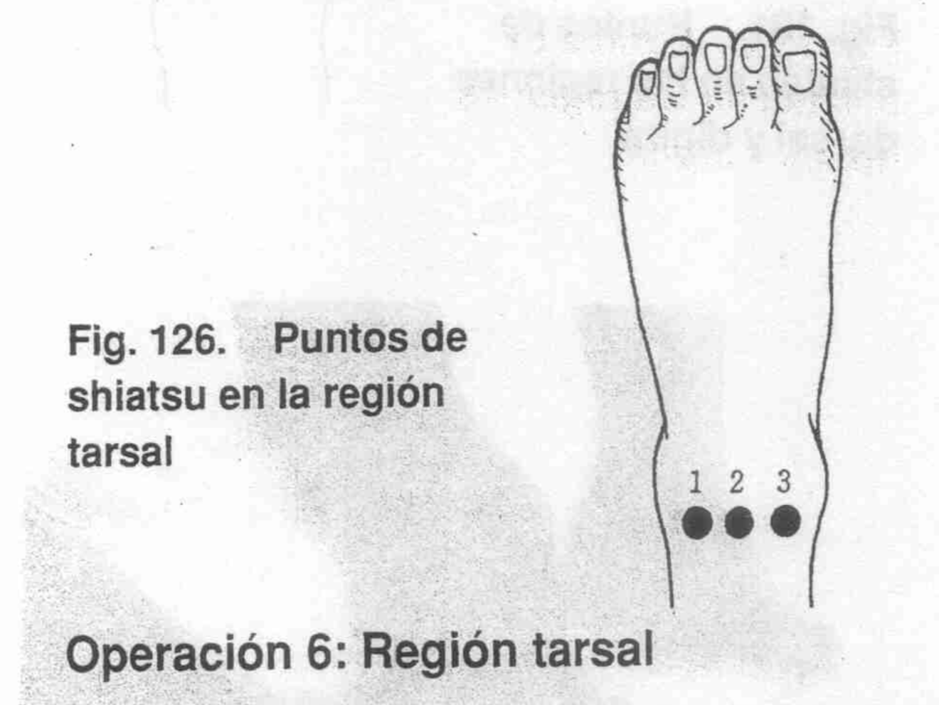 Sujeción Tobillo