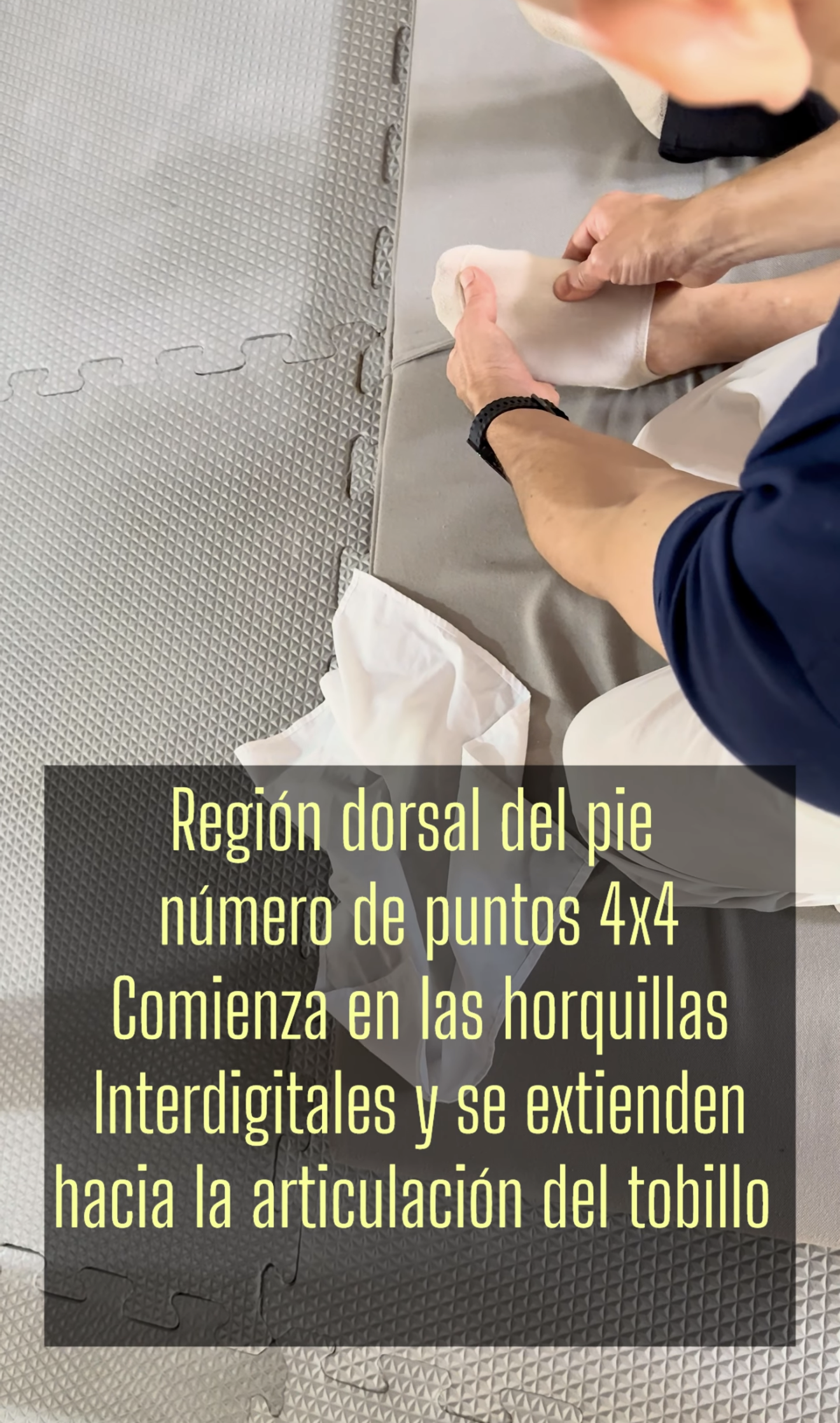 Esquema Canales Interóseos