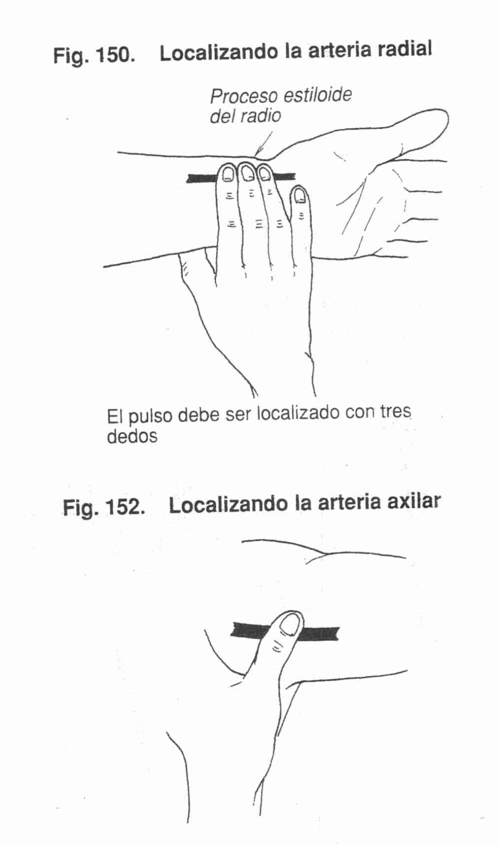 Palpación Pulso Radial