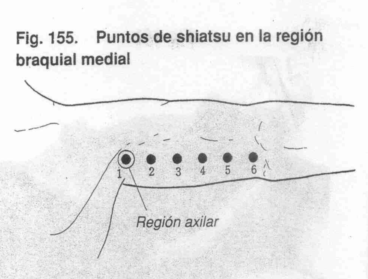 Toma de Presión V Braquial
